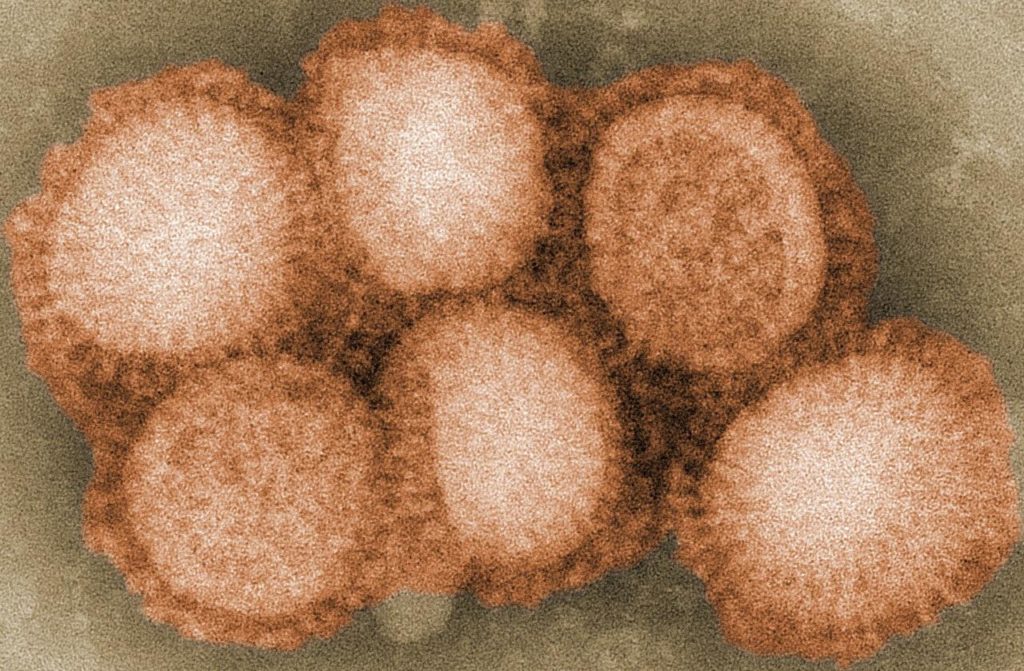 Germany Reports Outbreak Of “Highly Pathogenic” H5N8 Bird Flu Virus