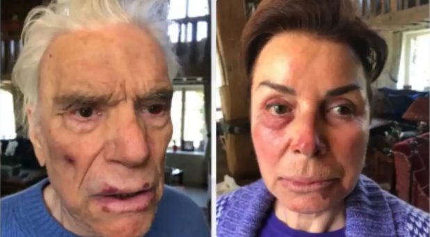 France: Far-Left Millionaire and Wife Get Beaten and Robbed by Diversity