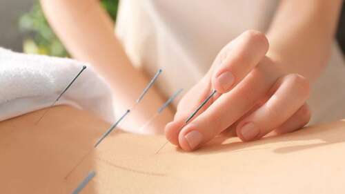 Study Reveals Previously Unknown Mechanism Behind Acupuncture’s Ability to Reduce Pain