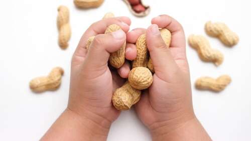Guidelines Call for Introduction of Peanuts During Infancy to Reduce Risk of Allergy