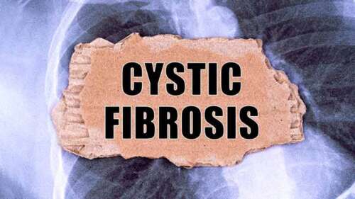 Natural Therapies for Cystic Fibrosis