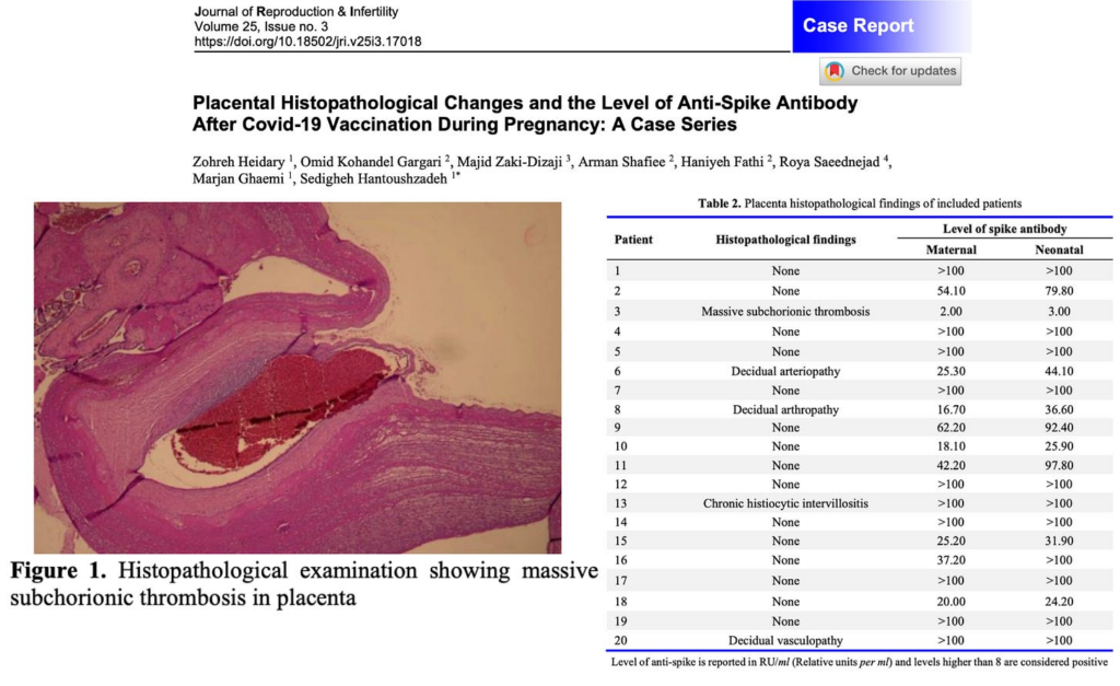 The Risks of COVID-19 “Vaccination” During Pregnancy: Evidence of Harm to Mothers and Developing Babies