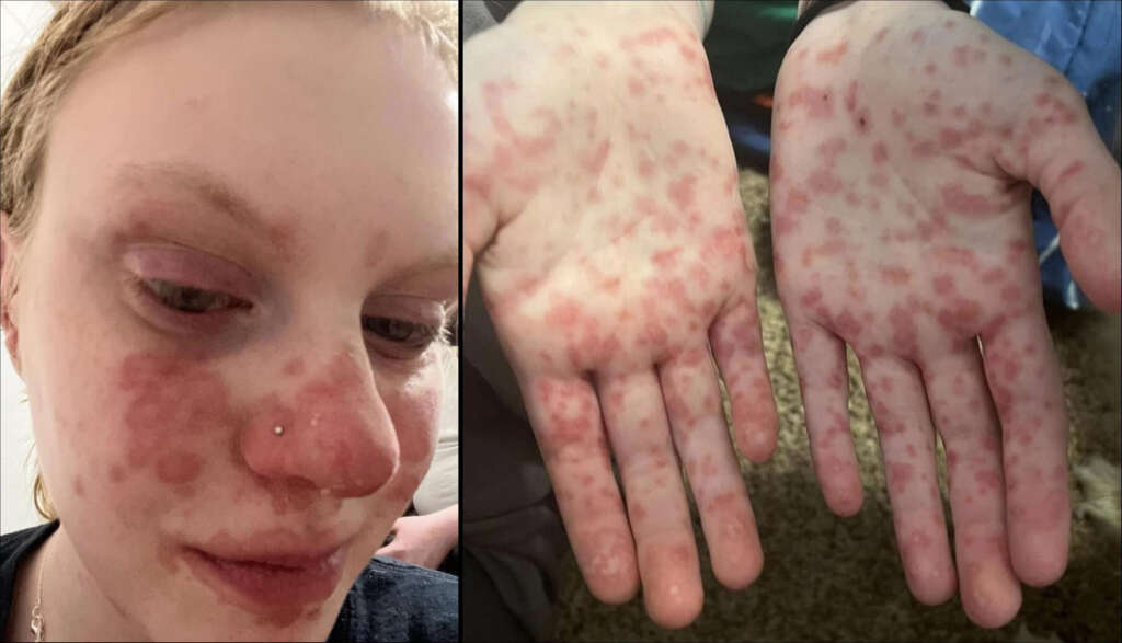 August 24 – Culling of the Goyim Continues