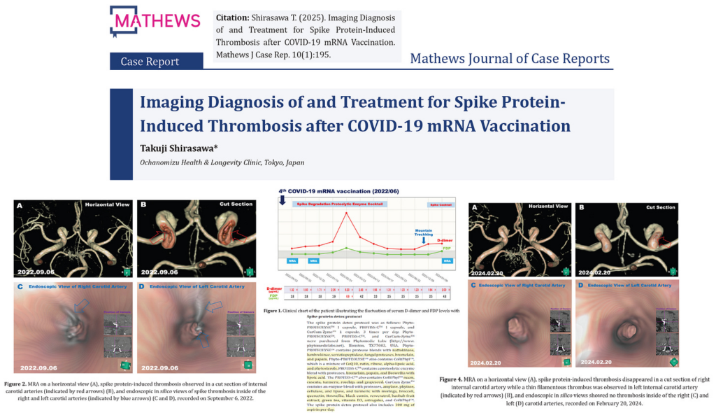BREAKING–First-in-Man Oral Proteolytic and Thrombolytic Dissolution of Intra-Arterial COVID-19 Vaccine Thrombi