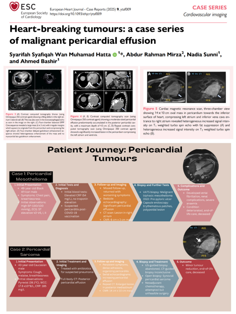 NEW STUDY – Fatal Malignant Cardiac Tumors Following COVID-19 mRNA Injection