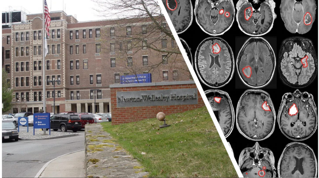 “Surge in brain tumours among nurses at Boston hospital triggers urgent inquiry”