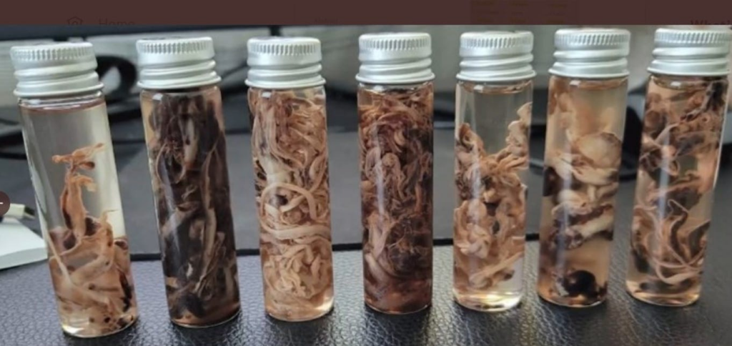 Microscopic and Biochemical Analysis of Anomalous White Fibrous Clots from Deceased mRNA Injection Recipients