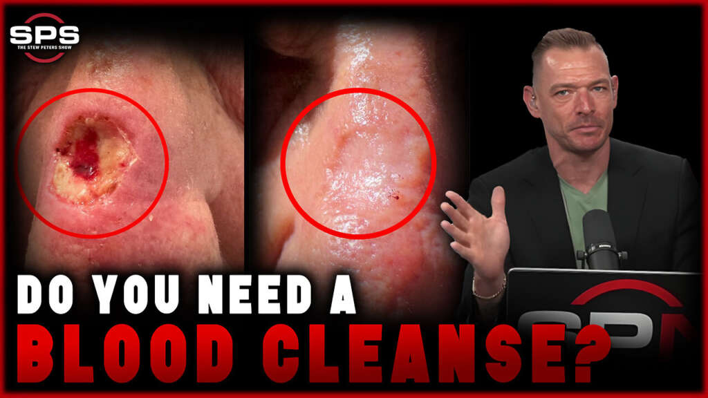 Could a BLOOD CLEANSE be What you Need to Change your Health?