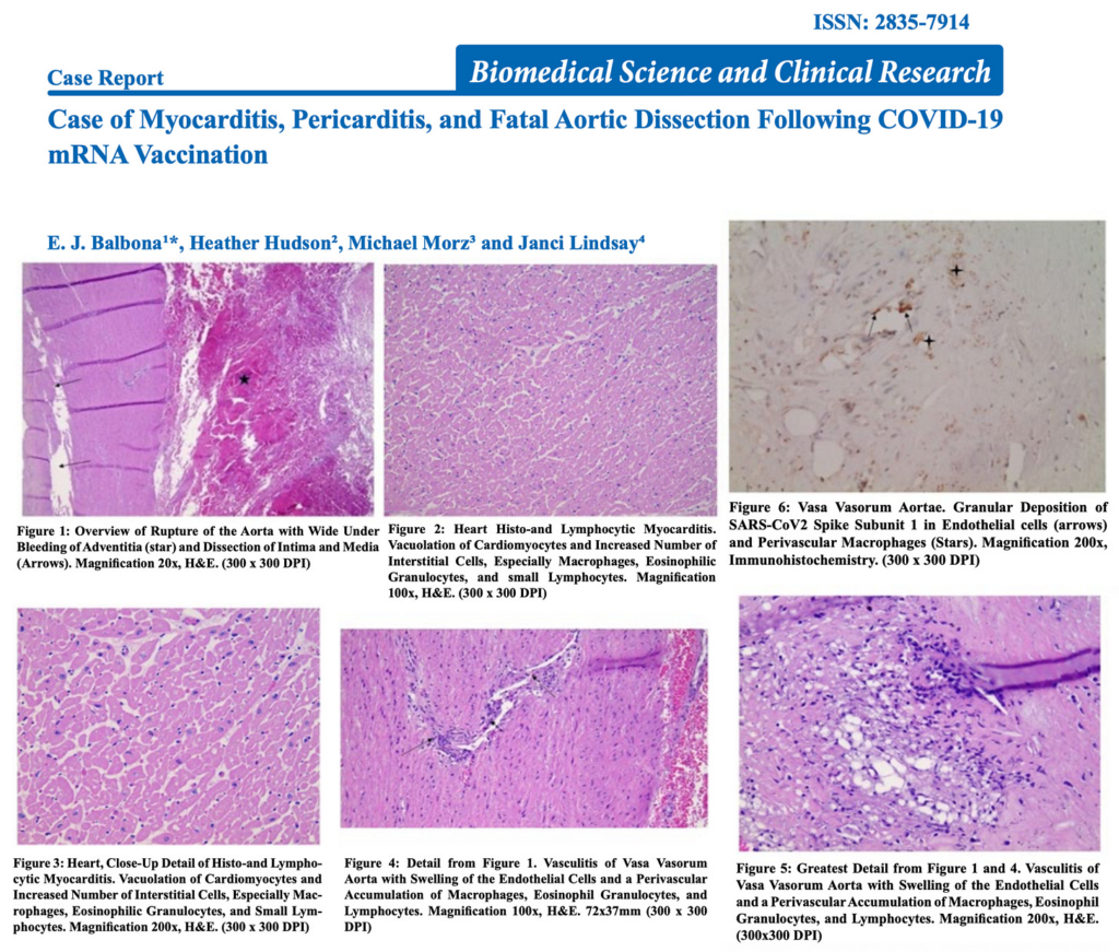A Mother Speaks Out After Her Son’s Sudden Death Following mRNA Injection