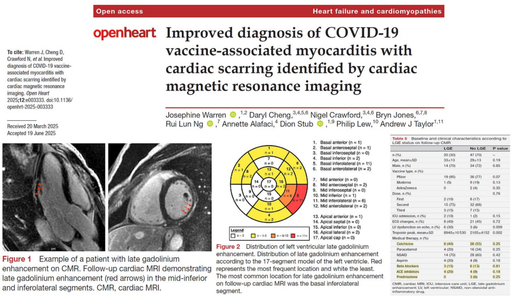 Cardiac MRI One Year after COVID-19 Vaccination Valuable in Detecting Heart Damage