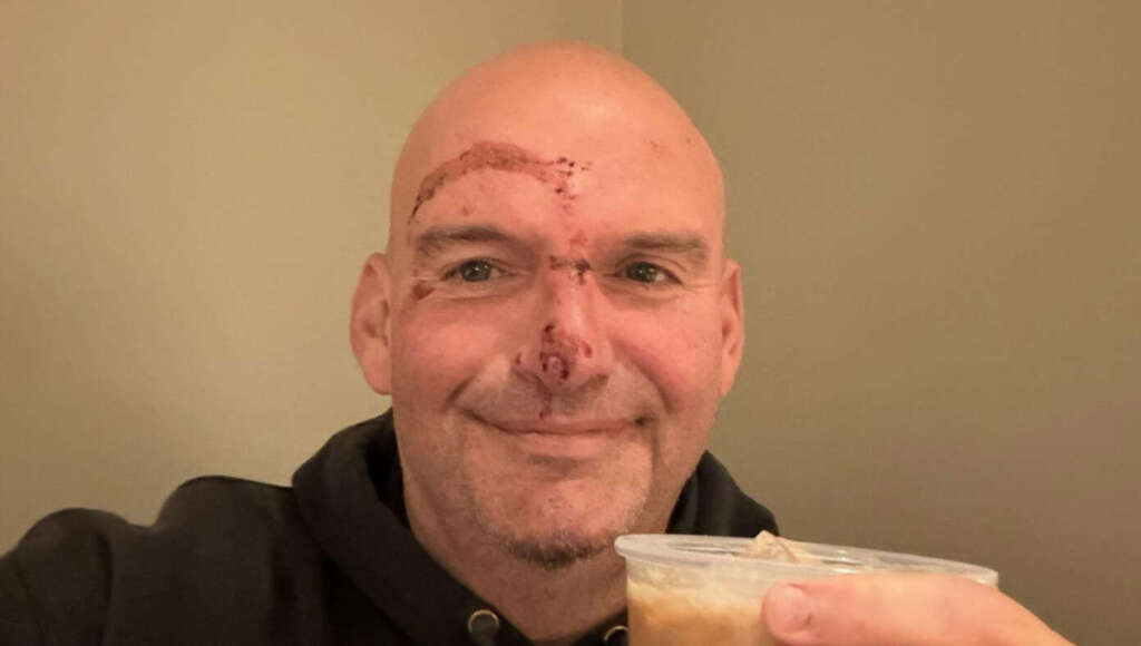 After Latest Head Injury, Fetterman Announces He’s Joining Whig Party (Satire)