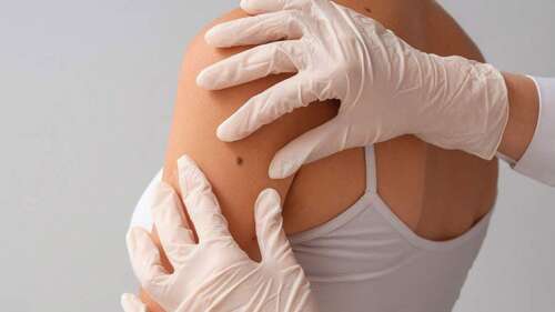 Niacinamide Found to Reduce the Risk of New Skin Cancers