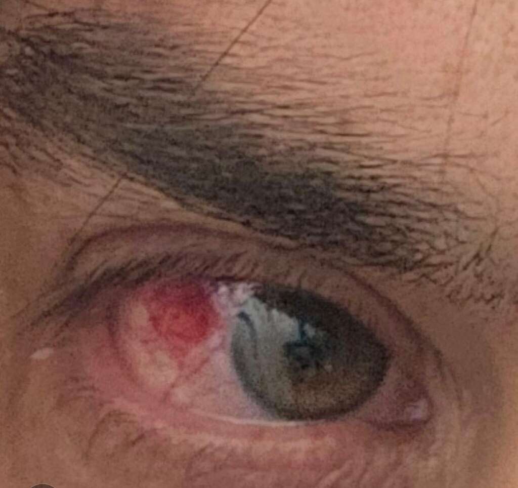 Ukraine mass surrender