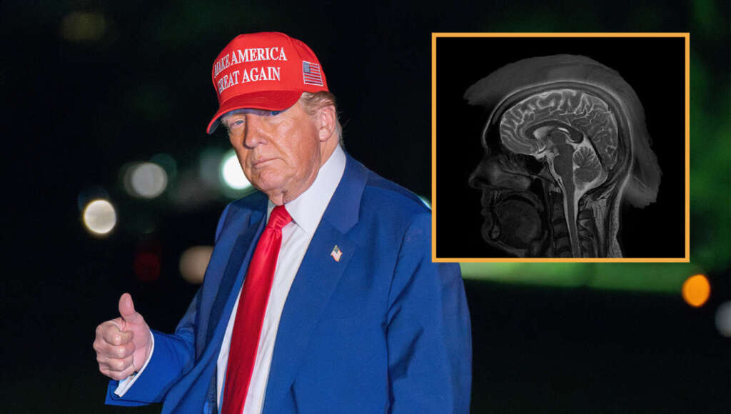 MRI Confirms President Donald Trump Has Incurable Advanced-Stage Patriotism (Satire)