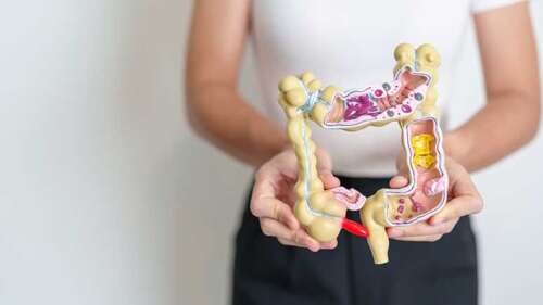 Severe Diverticulitis Is Rising Rapidly Among Younger Adults