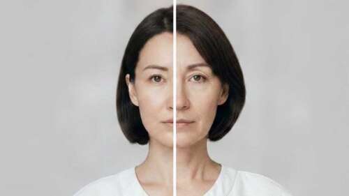 The Cause Behind ‘Ozempic Face’ and What You Can Do About It