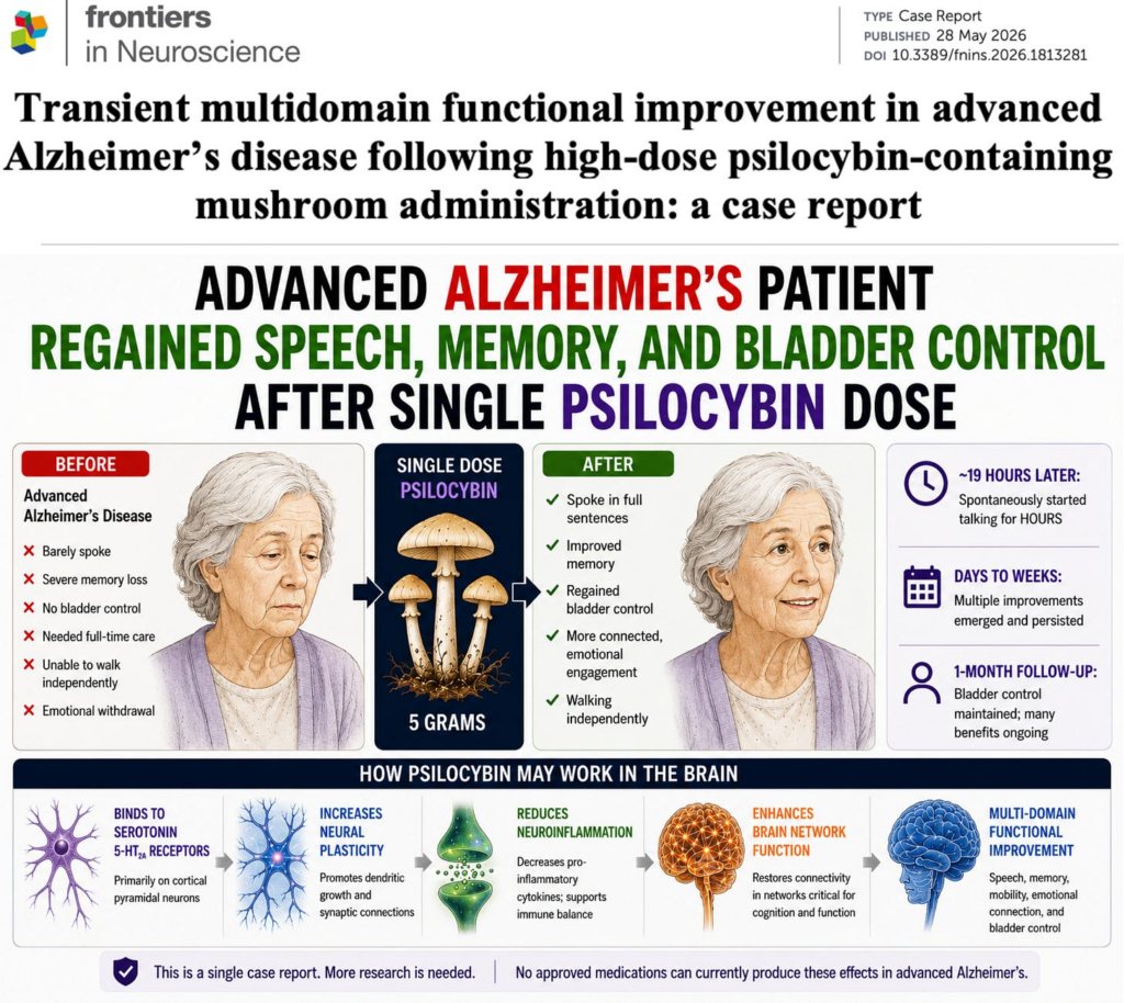 NEW STUDY: Advanced Alzheimer’s Patient Regained Speech, Memory, and Bladder Control After a Single Psilocybin Dose