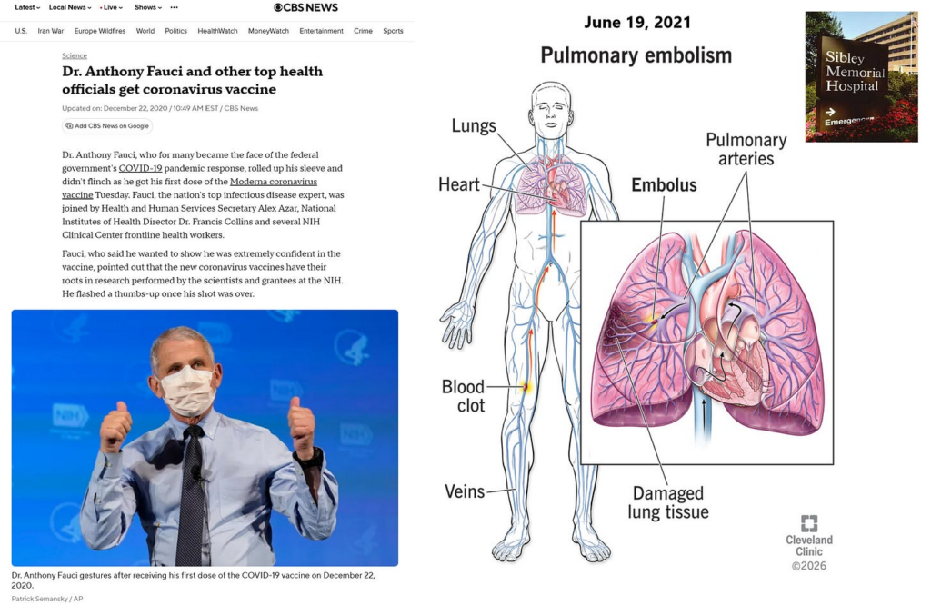 BREAKING–Dr. Anthony Fauci’s Post-Vaccination Pulmonary Embolism and the Disconnect in Public Health Policy